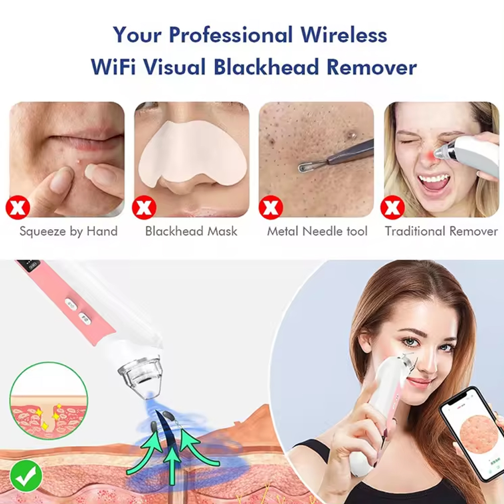 にきび用カメラ付き掃除機,にきび抽出器,フェイシャルノーズ, - Nasal Aspirator のレビューと価格